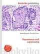 Squamous-cell carcinoma, Jesse Russell,Ronald Cohn 