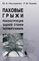 Паховые грыжи. Реконструкция задней стенки пахового канала. Монография, Ю. А. Нестеренко, Р. М. Газиев 