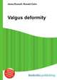Valgus deformity, Jesse Russell,Ronald Cohn 