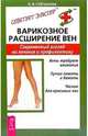 Варикозное расширение вен: Современный взгляд на лечение и профилактику., Степанова Ольга 