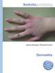 Dermatitis, Jesse Russell,Ronald Cohn 