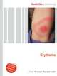 Erythema, Jesse Russell,Ronald Cohn 
