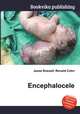 Encephalocele, Jesse Russell,Ronald Cohn 