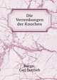 Die Verrenkungen der Knochen, Burger, Carl Gottlieb 