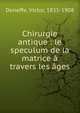 Chirurgie antique : le speculum de la matrice ? travers les ?ges, Deneffe, Victor, 1835-1908 