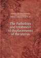The Pathology and treatment of displacements of the uterus, Schultze, Bernhard Sigmund, 1827-1919,Macan, Jameson J,Macan, Arthur V., ed 
