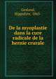 De la myoplastie dans la cure radicale de la hernie crurale, Gesland, Hippolyte, 1865- 