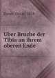 Uber Bruche der Tibia an ihrem oberen Ende, Exner, Oscar, 1858- 