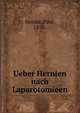 Ueber Hernien nach Laparotomieen, Semler, Paul, 1870- 