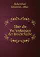 Uber die Verrenkungen der Kniescheibe, Hohenthal, Johannes, 1866- 