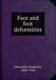 Face and foot deformities, Churchill, Frederick, 1843-1918 