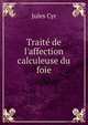 Trait? de l'affection calculeuse du foie, Jules Cyr 