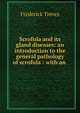 Scrofula and its gland diseases: an introduction to the general pathology of scrofula : with an ., Frederick Treves 