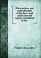 Rheumatism, and some diseases of the heart and other internal organs, considered in the ., Francis Hawkins 