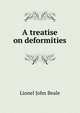 A treatise on deformities, Lionel John Beale 