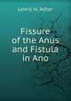 Fissure of the Anus and Fistula in Ano, Lewis H. Adler 