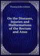 On the Diseases, Injuries and Malformations of the Rectum and Anus, Thomas John Ashton 