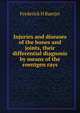 Injuries and diseases of the bones and joints, their differential diagnosis by means of the roentgen rays, Frederick H Baetjer 