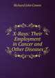 X-Rays: Their Employment in Cancer and Other Diseases, Richard John Cowen 