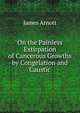 On the Painless Extirpation of Cancerous Growths by Congelation and Caustic, James Arnott 