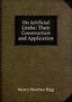 On Artificial Limbs: Their Construction and Application, Henry Heather Bigg 