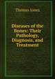 Diseases of the Bones: Their Pathology, Diagnosis, and Treatment, Thomas Jones 