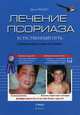 Лечение псориаза. Естественный путь, Джон Пегано 
