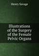 Illustrations of the Surgery of the Female Pelvic Organs, Henry Savage 