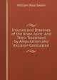 Injuries and Diseases of the Knee-Joint: And Their Treatment by Amputation and Excision Contrasted, William Paul Swain 
