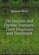 On Ovarian and Uterine Tumours: Their Diagnosis and Treatment, Spencer Wells 
