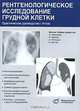 Рентгенологическое исследование грудной клетки, Н. Абанадор, Л. Кампер, Х. Раттунде, К. Центаи 