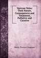 Varicose Veins: Their Nature, Consequences and Treatment, Palliative and Curative, Henry Thomas Chapman 