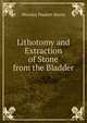 Lithotomy and Extraction of Stone from the Bladder, Worsley Poulett Harris 