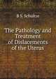 The Pathology and Treatment of Dislacements of the Uterus, B S. Schultze 