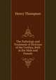 The Pathology and Treatment of Stricture of the Urethra, Both in the Male and Female, Henry Thompson 