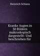 Kranke Augen in 30 Bildern makroskopisch dargestellt: Und beschrieben fur ., Heinrich Schiess 