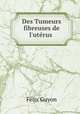 Des Tumeurs fibreuses de l