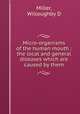 Micro-organisms of the human mouth : the local and general diseases which are caused by them, Willoughby D. Miller 