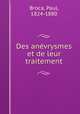 Des anvrysmes et de leur traitement, Broca, Paul, 1824-1880 