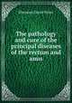 The pathology and cure of the principal diseases of the rectum and anus, Ebenezer David Silver 