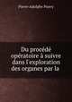 Du procede operatoire a suivre dans l