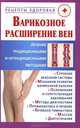Варикозное расширение вен. Лечение традиционными и нетрадиционными методами, В. В. Горбунов 