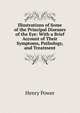 Illustrations of Some of the Principal Diseases of the Eye: With a Brief Account of Their Symptoms, Pathology, and Treatment, Henry Power 