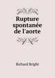 Rupture spontanee de l