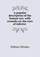 A popular description of the human eye: with remarks on the eyes of inferior ., William Whalley 