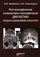 Рентгенографическая и компьютерно-томографическая диагностика острых и хронических синуситов, Семизоров Андрей Николаевич 