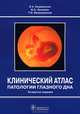 Клинический атлас патологии глазного дна - 4 изд., Кацнельсон Лев Абрамович, Лысенко В. С., Балишанская Т. И. 