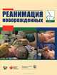 Реанимация новорожденных, 