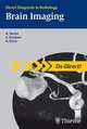 Brain Imaging, Sartor 