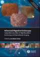 Advanced Digestive Endoscopy. Comprehensive Atlas of High Resolution Endoscopy and Narrowband Imaging, Robert Cohen 